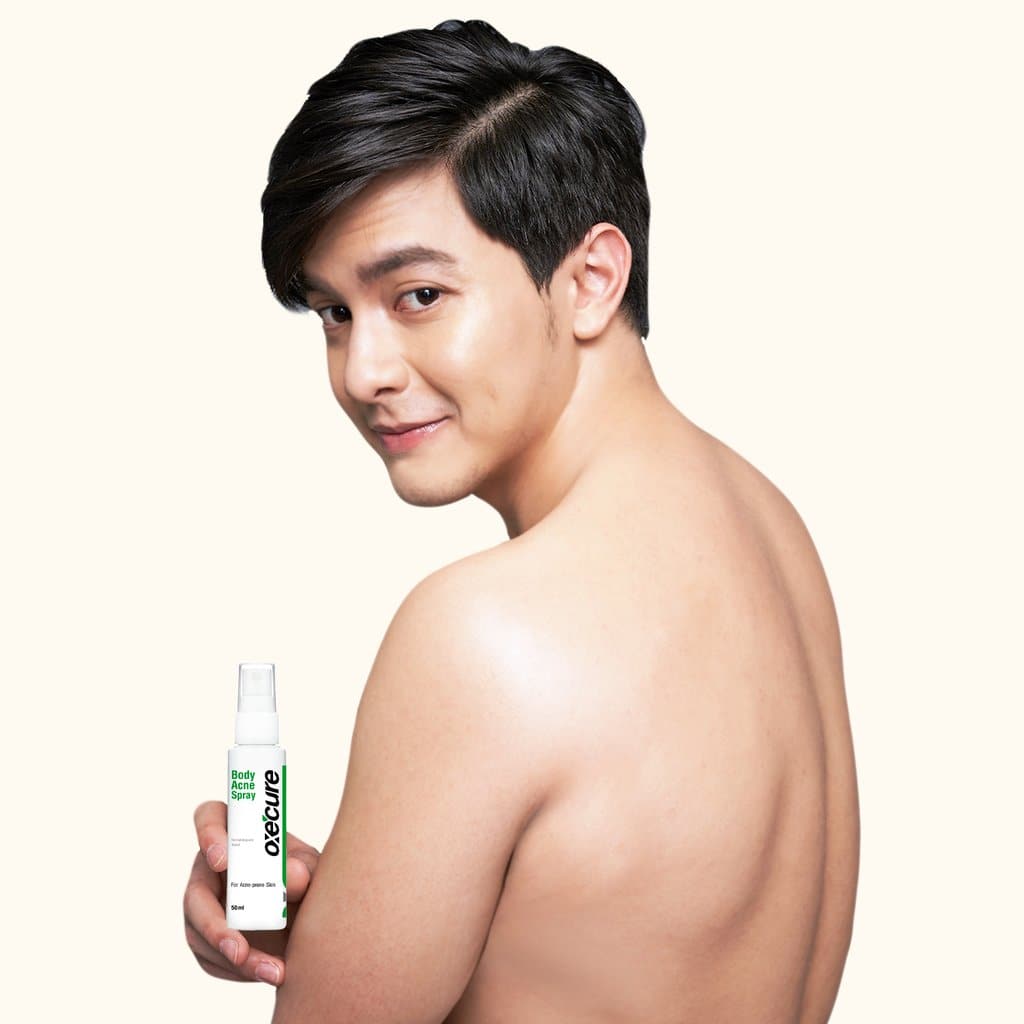 BodyAcneSprayAldenRichards1_20890255-a916-4a7a-a7cd-f1e7d7652882